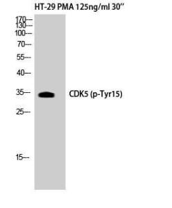 Western blot analysis of HT29 + PMA cells using Anti-CDK5 (phospho Tyr15) Antibody