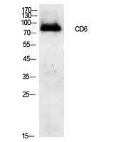 Anti-CD6 antibody