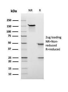 SDS-PAGE analysis of Anti-Nuclear Antigen Antibody [rNM106] under non-reduced and reduced conditions; showing intact IgG and intact heavy and light chains, respectively. SDS-PAGE analysis confirms the integrity and purity of the antibody