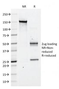 SDS-PAGE analysis of Anti-CD43 Antibody [DF-T1] under non-reduced and reduced conditions; showing intact IgG and intact heavy and light chains, respectively. SDS-PAGE analysis confirms the integrity and purity of the antibody.