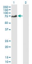 Anti-LCP2 Rabbit Polyclonal Antibody