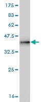 Anti-CDC42BPA Mouse Monoclonal Antibody [clone: 1G7]