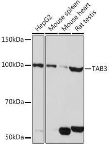 Western blot analysis of extracts of various cell lines, using Anti-TAB3 Antibody (A308359) at 1:1,000 dilution. The secondary antibody was Goat Anti-Rabbit IgG H&L Antibody (HRP) at 1:10,000 dilution.