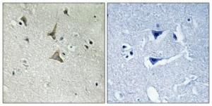 Immunohistochemical analysis of paraffin-embedded human brain using Anti-CDK5 (phospho Tyr15) Antibody 1:100 (4°C overnight). The right hand panel represents a negative control, where the antibody was pre-incubated with the immunising peptide.