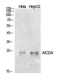 Anti-AICDA Rabbit Polyclonal Antibody