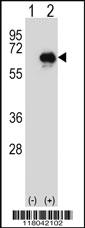 Anti-TMTC4 Rabbit Polyclonal Antibody