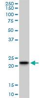 Anti-RAB7B Mouse Monoclonal Antibody [clone: 3B3]