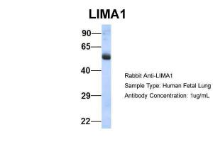 Anti-LIMA1 Rabbit Polyclonal Antibody