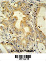 Anti-TNFRSF6B Rabbit Polyclonal Antibody (AP (Alkaline Phosphatase))