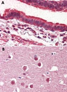 Anti-GPR98 Rabbit Polyclonal Antibody