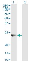 Anti-RAB7B Mouse Monoclonal Antibody [clone: 3B3]