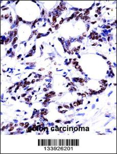 Anti-HNRNPM Rabbit Polyclonal Antibody (APC (Allophycocyanin))