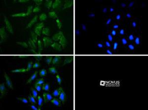 Anti-MUTYH Rabbit Polyclonal Antibody