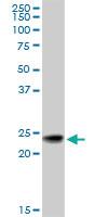 Anti-RAB7B Mouse Monoclonal Antibody [clone: 3B3]