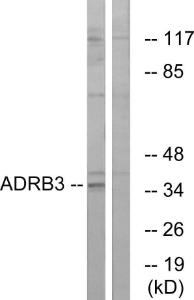 Western blot analysis of lysates from K562 cells using Anti-ADRB3 Antibody. The right hand lane represents a negative control, where the antibody is blocked by the immunising peptide