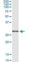 Anti-TRIM72 Antibody Pair