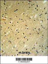 Anti-BCOR Rabbit polyclonal antibody unconjugated