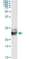 Anti-RAB7B Mouse Monoclonal Antibody [clone: 3B3]