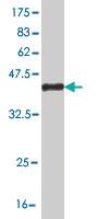 Anti-FCMR Mouse Monoclonal Antibody [clone: 1E4]