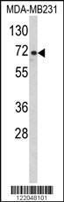 Anti-ARHGAP18 Rabbit Polyclonal Antibody (APC (Allophycocyanin))