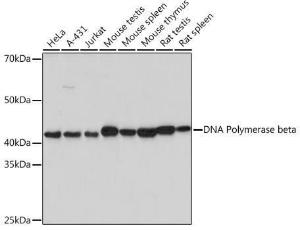 Western blot analysis of extracts of various cell lines, using Anti-DNA Polymerase beta Antibody [ARC0752] (A307402) at 1:1,000 dilution. The secondary antibody was Goat Anti-Rabbit IgG H&L Antibody (HRP) at 1:10,000 dilution.