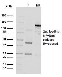 SDS-PAGE analysis of Anti-HER2 Antibody [ERBB2/3092] under non-reduced and reduced conditions; showing intact IgG and intact heavy and light chains, respectively. SDS-PAGE analysis confirms the integrity and purity of the antibody.