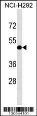 Anti-INTS4L1 Rabbit Polyclonal Antibody (AP (Alkaline Phosphatase))