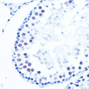 Immunohistochemistry analysis of paraffin-embedded rat testis using Anti-DNA Polymerase beta Antibody [ARC0752] (A307402) at a dilution of 1:100 (40x lens). Perform microwave antigen retrieval with 10 mM PBS buffer pH 7.2 before commencing with IHC staining protocol.