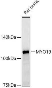 Western blot analysis of extracts of Rat testis, using Anti-MYO19 Antibody [ARC2919] (A308360) at 1:500 dilution. The secondary antibody was Goat Anti-Rabbit IgG H&L Antibody (HRP) at 1:10,000 dilution.