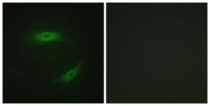 Immunofluorescence analysis of HepG2 cells using Anti-CD4 (phospho Ser433) Antibody. The right hand panel represents a negative control, where the antibody was pre-incubated with the immunising peptide