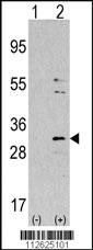 Anti-NNMT Rabbit Polyclonal Antibody