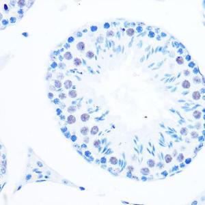 Immunohistochemistry analysis of paraffin-embedded mouse testis using Anti-DNA Polymerase beta Antibody [ARC0752] (A307402) at a dilution of 1:100 (40x lens). Perform microwave antigen retrieval with 10 mM PBS buffer pH 7.2 before commencing with IHC staining protocol.