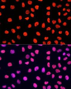 Immunofluorescence analysis of HeLa cells, using Goat Anti-Rabbit IgG H&L Antibody (Cyanine 3, (A17341) as the primary antibody at a dilution of 1:100. The cells were incubated with the primary antibody overnight at 4°C.