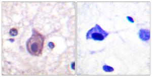 Immunohistochemical analysis of paraffin-embedded human brain using Anti-CD4 (phospho Ser433) Antibody. The right hand panel represents a negative control, where the antibody was pre-incubated with the immunising peptide