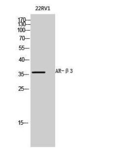 Western blot analysis of 22RV1 cells using Anti-ADRB3 Antibody