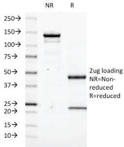 SDS-PAGE analysis of Anti-Transgluta minase II Antibody [SPM592] under non-reduced and reduced conditions; showing intact IgG and intact heavy and light chains, respectively. SDS-PAGE analysis confirms the integrity and purity of the Antibody