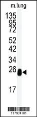 Anti-DCXR Rabbit Polyclonal Antibody