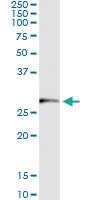 Anti-TRIM72 Antibody Pair