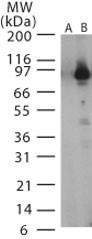 Anti-Anthrax LF Rabbit Polyclonal Antibody