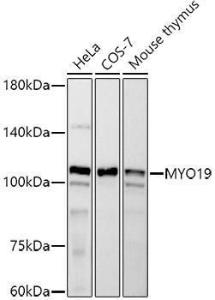 Western blot analysis of extracts of various cell lines, using Anti-MYO19 Antibody [ARC2919] (A308360) at 1:500 dilution. The secondary antibody was Goat Anti-Rabbit IgG H&L Antibody (HRP) at 1:10,000 dilution.