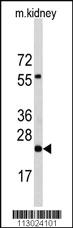 Anti-PEMT Rabbit Polyclonal Antibody