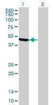 Anti-ENO1 Mouse monoclonal antibody [clone: 8G8]