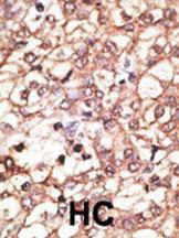 Anti-KREMEN1 Rabbit Polyclonal Antibody (AP (Alkaline Phosphatase))