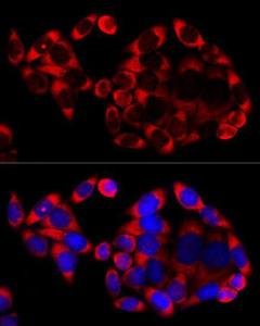 Immunofluorescence analysis of HeLa cells, using Goat Anti-Rabbit IgG H&L Antibody (Cyanine 3, (A17341) as the primary antibody at a dilution of 1:100. The cells were incubated with the primary antibody overnight at 4°C.