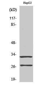 Western blot analysis of various cells using Anti-CATG (cleaved Ile21) Antibody