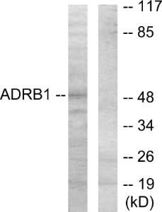 Western blot analysis of lysates from HT-29 cells using Anti-ADRB1 Antibody The right hand lane represents a negative control, where the antibody is blocked by the immunising peptide