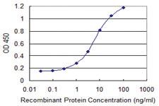 Anti-ZNF154 Mouse Monoclonal Antibody [clone: 6G11]