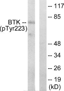 Western blot analysis of lysates from HeLa cells treated with Serum 10% 15' using Anti-BTK (phospho Tyr223) Antibody. The right hand lane represents a negative control, where the antibody is blocked by the immunising peptide