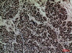 Anti-CD2 Rabbit Polyclonal Antibody