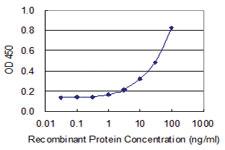 Anti-ZNF155 Mouse Monoclonal Antibody [clone: 2F11]